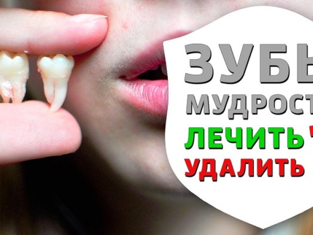 Is it necessary and dangerous to remove wisdom tooth? Removing the wisdom tooth: indications and contraindications