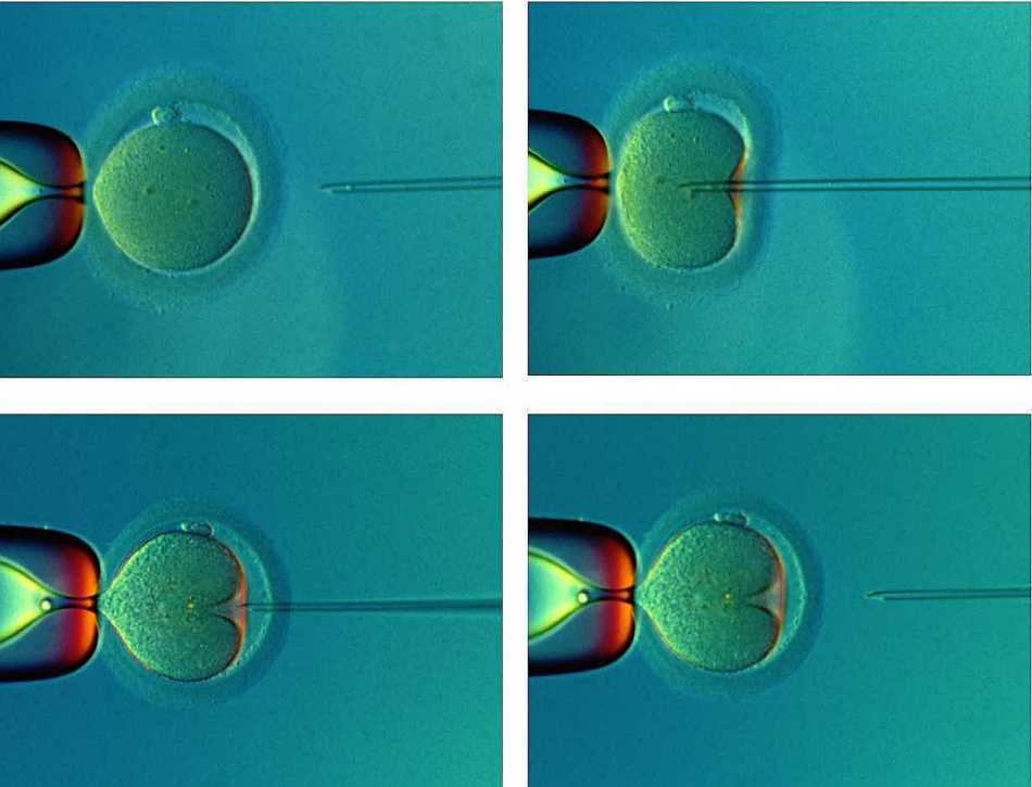 Stages of fertilization of the egg.