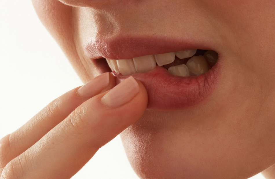 La morsure des lèvres peut provoquer un développement de l'héilite