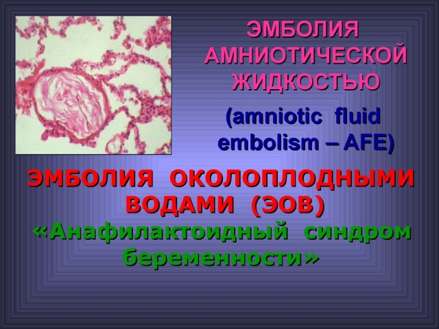 Embolie par le liquide amniotique de la femme en travail dans la césarienne: causes, traitement, prévention. Fournir une assistance d'urgence à une femme en embolie par le liquide amniotique