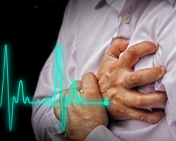 Milyen súlyt lehet felemelni a miokardiális infarktus, stroke után? Miért nem lehet megemelni egy miokardiális infarktus után a stroke -ot? Mit nem lehet megtenni a miokardiális infarktus és a stroke után?