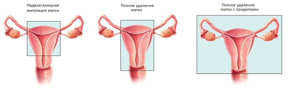 Может быть частичное