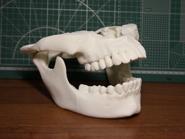 Анатомическое строение и функции верхней и нижней челюсти человека: схема с описанием, размеры