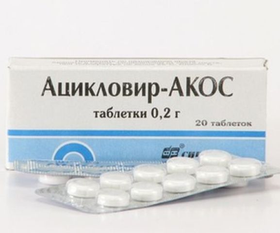 Aciklovir - Használati utasítások: tabletták, kenőcs, gyertyák, injekciók. Aciklovir terhesség alatt, gyermekek