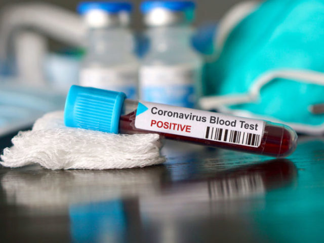 Apa yang harus dilakukan jika Anda prontak dengan coronavirus yang sakit agar tidak sakit?