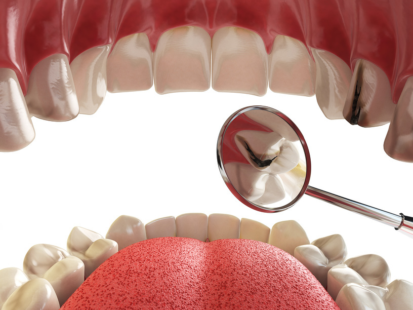 How does pH saliva affect the oral cavity?