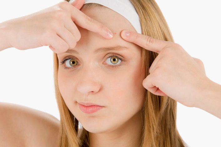 Remède de la pharmacie pour l'acné interne sous-cutanée sur le visage