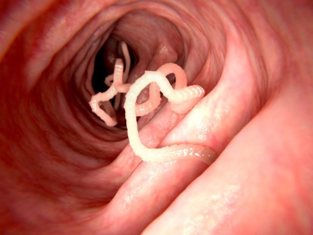 Comment se débarrasser des parasites dans les intestins d'une personne à la maison vous-même: une liste de médicaments, des recettes folkloriques, des conseils, des vidéos