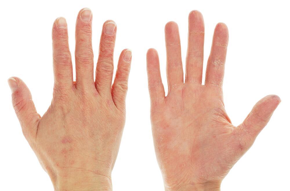 Что пальцы говорят о характере человека?