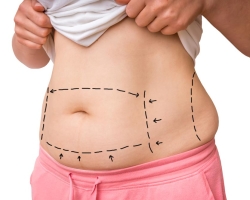 Kako odstraniti maščobo na trebuhu in se znebiti ženske po 50 letih: vaje, prehrana, priporočila nutricionista in trenerja, ocene