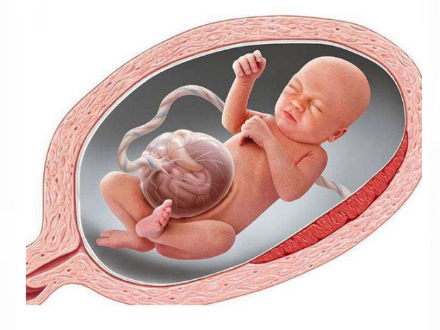 The fetal gastroshisis in newborns: causes, diagnosis and treatment