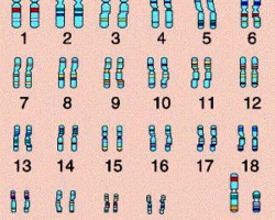 What is the number of chromosomes in the cells of a healthy person? What will happen if the chromosomes are more or less?