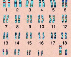 Vad är antalet kromosomer i cellerna hos en frisk person? Vad händer om kromosomerna är mer eller mindre?