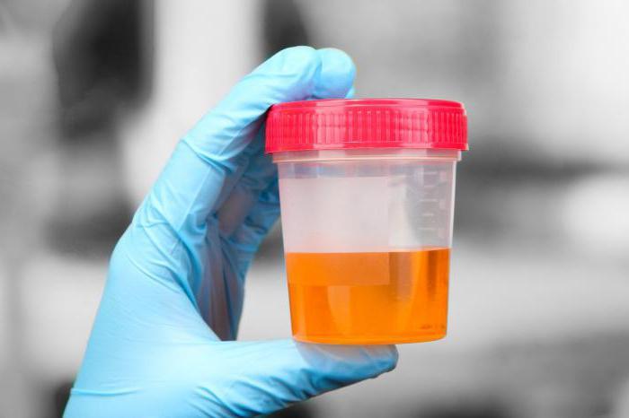 Muddy and dark urine with an increased level of white blood cells during pregnancy