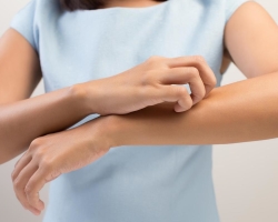 The most effective means against itching of the skin: a list of drugs, ointments from irritation. Why does an allergist with skin itching prescribing antibiotics?