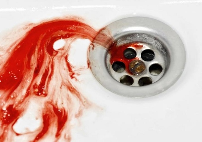 Rinse blood in a dream - try to get rid of problems in life.