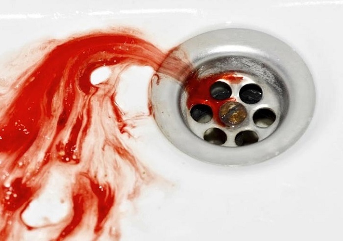 Risciacquare il sangue in un sogno: cerca di sbarazzarti dei problemi nella vita.