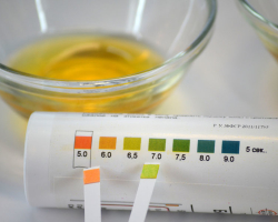 Bagaimana cara mengukur pH urin, air liur, darah, vagina, cairan di rumah menggunakan kertas indikator lacmus? Di mana kertas Lakmus dijual dan perangkat pengukuran pH?