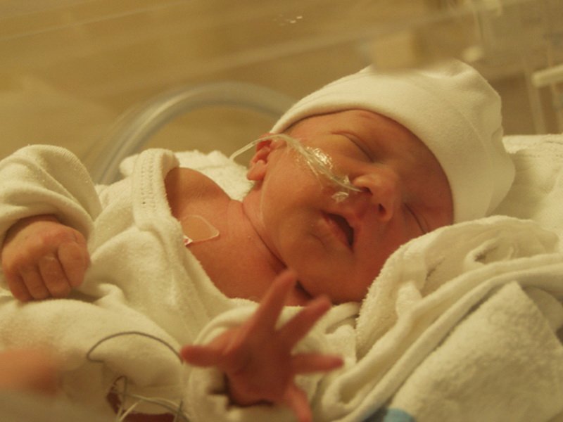 Новорожденный помещен в кювез и дышит через специальные трубки
