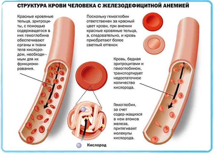 Comparaison de la structure du sang