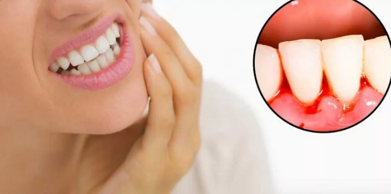 Dlevarna bolezen, krvavitev: vzrok za širjenje bakterij in videz neprijetnega vonja iz ust
