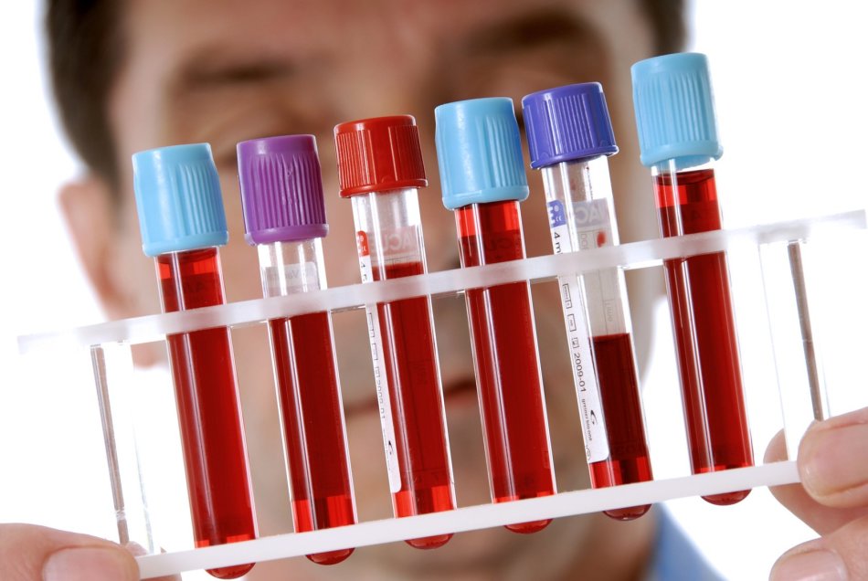 Apakah mungkin untuk menyumbangkan darah untuk HCG di siang hari atau di malam hari?
