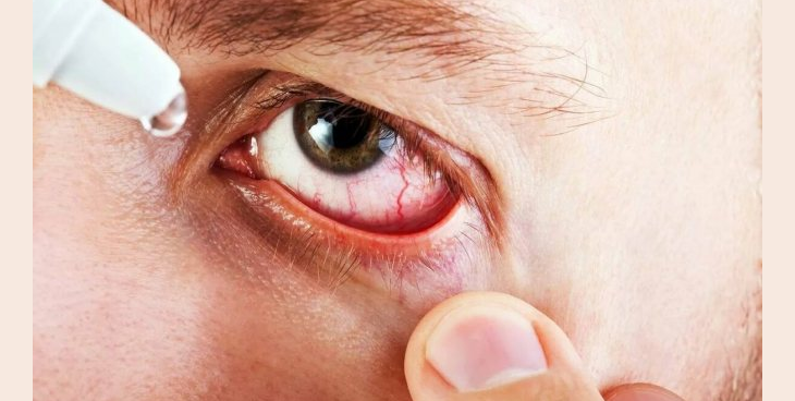 With conjunctivitis and complications of other diseases, temperature may rise