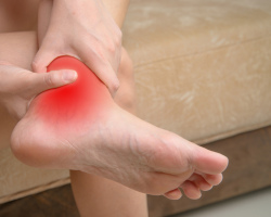 Extoartrosis sendi pergelangan kaki: penyebab perkembangan, gejala, metode pengobatan
