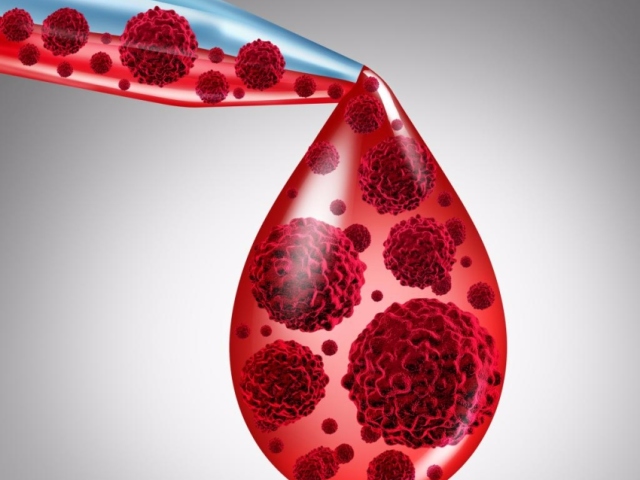 От чего густеет кровь: причины, продукты, сгущающие кровь