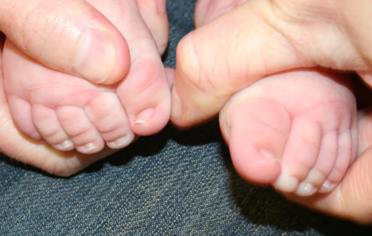 Покраснение, шелушение и зуд между пальцев на ногах у ребенка