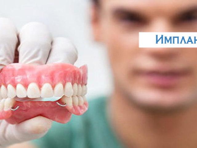 Implantation de dents: étapes, conséquences et méthodes de la procédure, restrictions, contre-indications, complications possibles