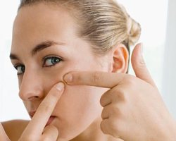 What acne on the cheeks? Acne on cheeks in women, men, adolescents and children: Reason