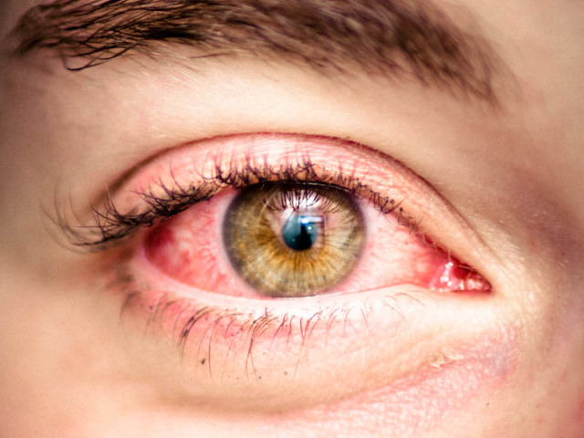 Apa yang akan terjadi jika penyedot debu dibawa ke mata? Apakah mungkin mengisap mata dengan penyedot debu?