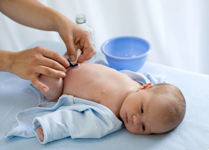 Обработка пупка - ежедневная процедура для малыша в первый месяц его жизни.
