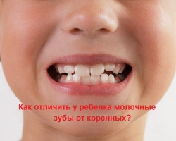 Kako razlikovati mlečni zob od korena: fotografije z razlagami. - Modrost zob - avtohtono ali mleko? Ali se vsi mlečni zobje spremenijo v avtohtone? Kakšne težave so povezane s spremembo mlečnega zoba na korenini: kdaj se naredi x -ray?