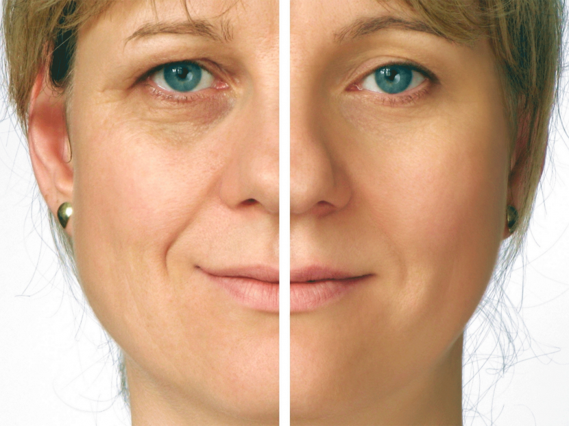 A woman after 40, in which one part of the face is natural, and an anti -aging makeup is applied to the second