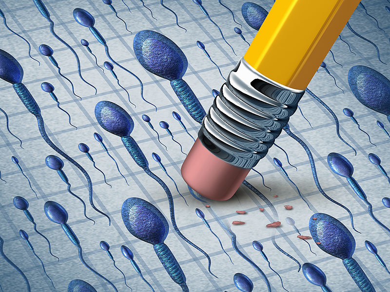 Obstructive Azoospermia The most common form of male infertility