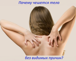 A woman, men began to itch the body in different places for no apparent reason and rashes: why?