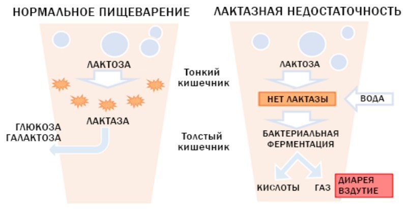 Нормално храносмилане и дефицит на лактаза