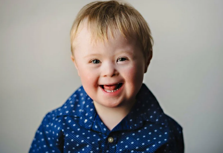 A child with Down syndrome differs from a child with a diagnosis of autism