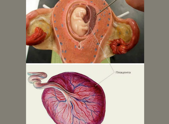 Pathology of the placenta