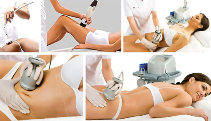 Step -by -step lipolysis in different parts of the body