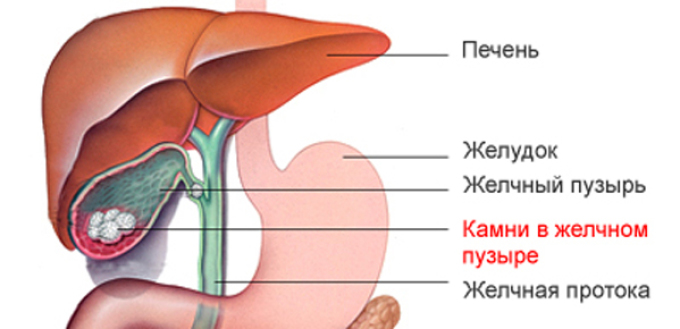 Симптом болести жучних камена - сечење боли у правом хипохонству.