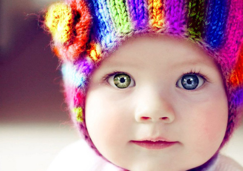 Girl with congenital heterochromia