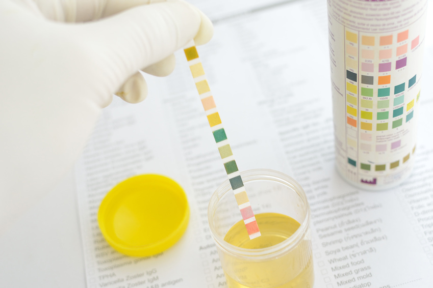 Conducting an analysis of urine to pregnant women on leukocytes
