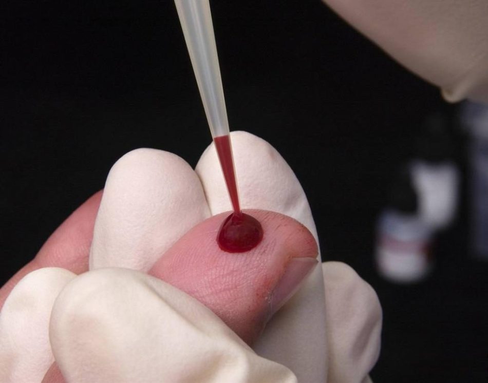A hematofóbia nagyon elrontja az idegeket, ha szükséges a vér adományozásához