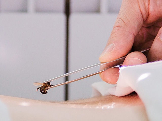 Apitherapy - treatment with bees at home: indications, biologically active points for different diseases, contraindications, side effects, exacerbations. Allowed number of bees bites per day, for the course of treatment and the duration of treatment