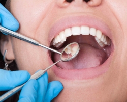 Is it worth it and how to treat a wisdom tooth: tips, reviews, complications