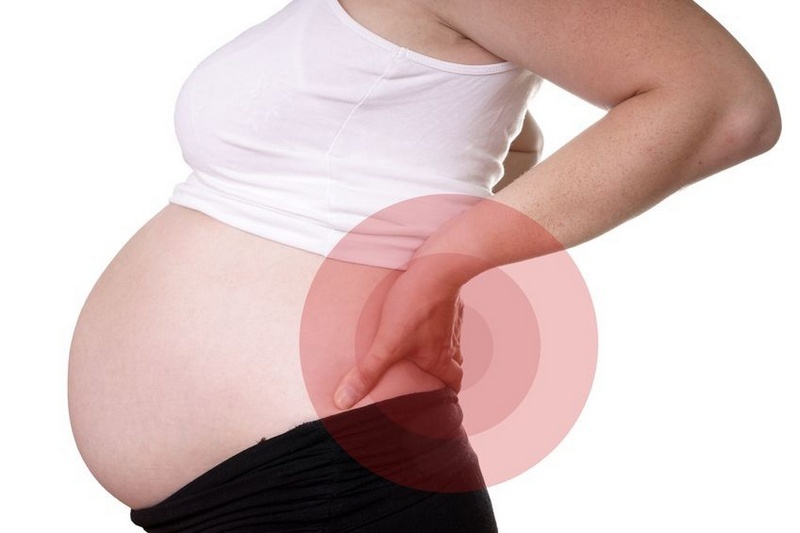 Bagaimana cara merawat ishias selama kehamilan?