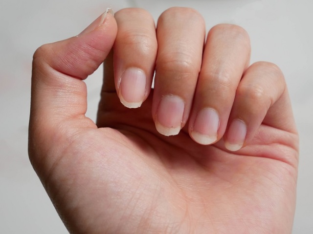 Почему слоятся и ломаются ногти: 10 причин ломких и хрупких ногтей у взрослых, детей, беременных. Почему ломаются ногти под гель лаком и шеллаком: причины, правила ухода за наращенными ногтями
